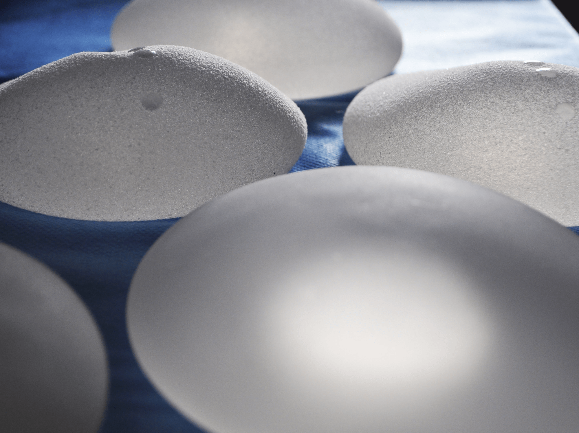 After Breast Augmentation Surgery, Common Questions